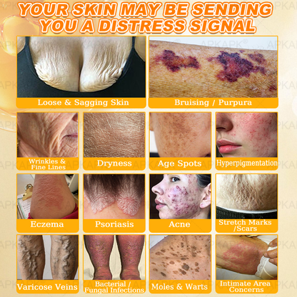 Official Store | 𝐀𝐏𝐊𝐀𝐏𝐊® 𝟖-𝐈𝐧-𝟏 𝐁𝐞𝐞 𝐕𝐞𝐧𝐨𝐦 & 𝐓𝐚𝐥𝐥𝐨𝐰 𝐒𝐤𝐢𝐧 𝐅𝐢𝐫𝐦𝐢𝐧𝐠 & 𝐓𝐫𝐞𝐚𝐭𝐦𝐞𝐧𝐭 𝐂𝐫𝐞𝐚𝐦 (Effective Within 7 Days)Bee Venom + Tallow · 7X Deep Hydration, targets wrinkles, sagging, stretch marks, dark spots, purpura, inflammations and more