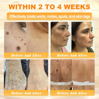 Official Store | 𝐀𝐏𝐊𝐀𝐏𝐊® 𝟖-𝐈𝐧-𝟏 𝐁𝐞𝐞 𝐕𝐞𝐧𝐨𝐦 & 𝐓𝐚𝐥𝐥𝐨𝐰 𝐒𝐤𝐢𝐧 𝐅𝐢𝐫𝐦𝐢𝐧𝐠 & 𝐓𝐫𝐞𝐚𝐭𝐦𝐞𝐧𝐭 𝐂𝐫𝐞𝐚𝐦 (Effective Within 7 Days)Bee Venom + Tallow · 7X Deep Hydration, targets wrinkles, sagging, stretch marks, dark spots, purpura, inflammations and more