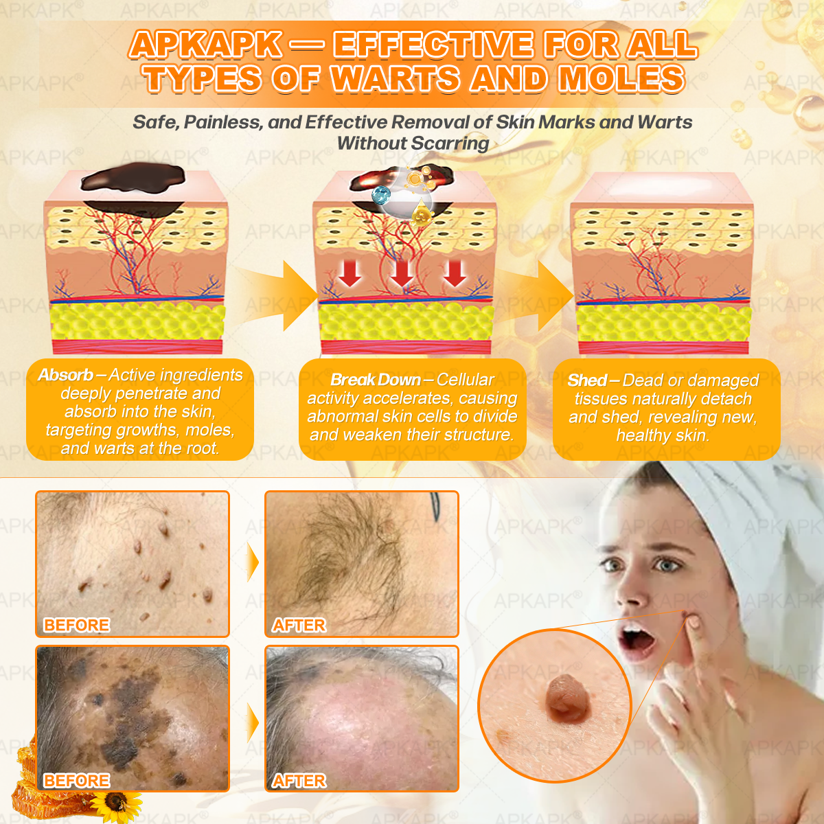 Official Store | 𝐀𝐏𝐊𝐀𝐏𝐊® 𝟖-𝐈𝐧-𝟏 𝐁𝐞𝐞 𝐕𝐞𝐧𝐨𝐦 & 𝐓𝐚𝐥𝐥𝐨𝐰 𝐒𝐤𝐢𝐧 𝐅𝐢𝐫𝐦𝐢𝐧𝐠 & 𝐓𝐫𝐞𝐚𝐭𝐦𝐞𝐧𝐭 𝐂𝐫𝐞𝐚𝐦 (Effective Within 7 Days)Bee Venom + Tallow · 7X Deep Hydration, targets wrinkles, sagging, stretch marks, dark spots, purpura, inflammations and more