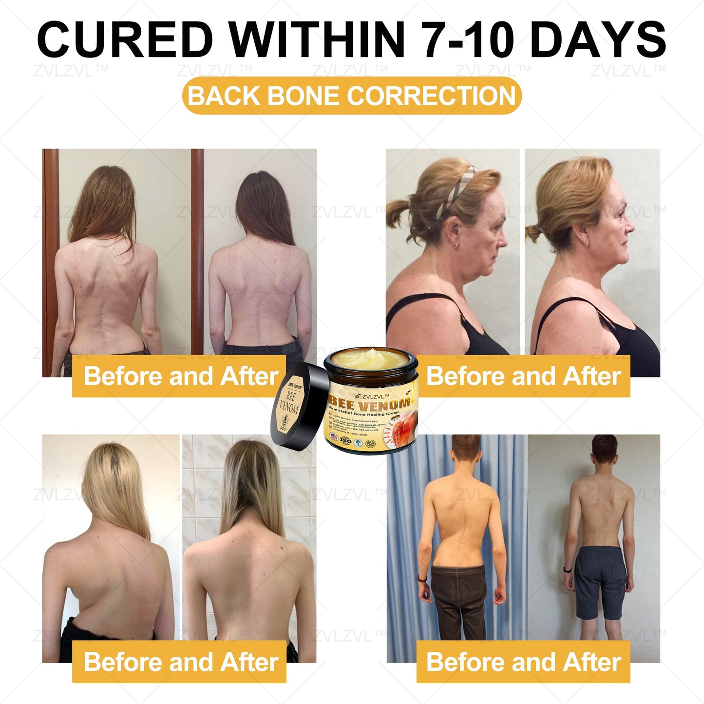 ZVLZVL™ Bee Venom Instant Pain Relief Arthritis Therapy Cream💪👨‍⚕️👨‍⚕️(Specially for older adults)