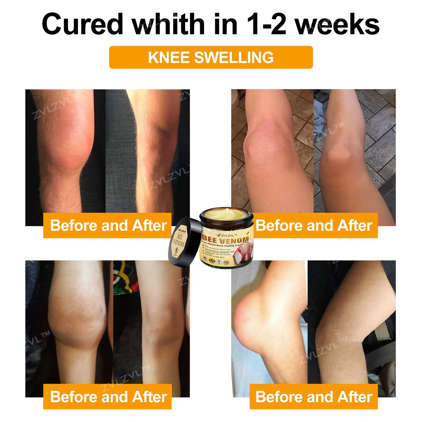ZVLZVL™ Bee Venom Instant Pain Relief Arthritis Therapy Cream👨‍⚕️(Specially for older adults)