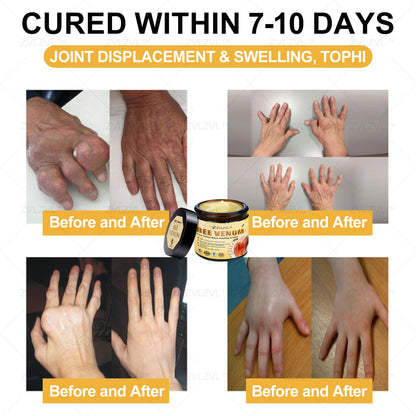 ZVLZVL™ Bee Venom Instant Pain Relief Arthritis Therapy Cream💪👨‍⚕️👨‍⚕️(Specially for older adults)