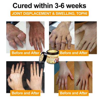 ZVLZVL™ Bee Venom Instant Pain Relief Arthritis Therapy Cream👨‍⚕️(Specially for older adults)