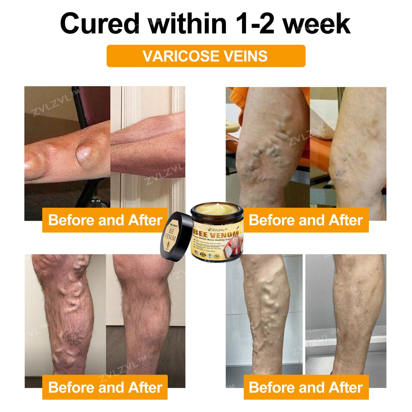 ZVLZVL™ Bee Venom Instant Pain Relief Arthritis Therapy Cream👨‍⚕️(Specially for older adults)